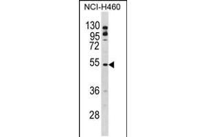 Western blot analysis of BLNK Antibody in NCI-H460 cell line lysates (35ug/lane)