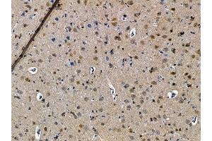 ABIN7095526 and ABIN7099583 at 1/100 staining rat brain tissue by IHC-P. (CXXC1 antibody)