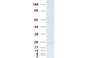 Validation with Western Blot (PPIB Protein (Myc-DYKDDDDK Tag))