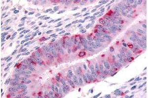Human Uterus (formalin-fixed, paraffin-embedded) stained with DPP8 antibody ABIN213565 at 20 ug/ml followed by biotinylated goat anti-rabbit IgG secondary antibody ABIN481713, alkaline phosphatase-streptavidin and chromogen. (DPP8 antibody  (N-Term))