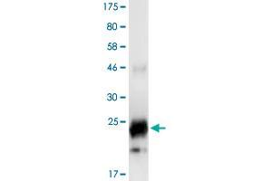 Image no. 2 for Tumor Necrosis Factor (Ligand) Superfamily, Member 14 (TNFSF14) (AA 89-240) protein (His-DYKDDDDK-Strep II Tag) (ABIN1323228) (TNFSF14 Protein (AA 89-240) (His-DYKDDDDK-Strep II Tag))