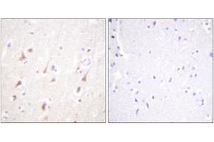 Immunohistochemistry analysis of paraffin-embedded human brain, using IRS-1 (Ab-794) Antibody. (IRS1 antibody  (AA 760-809))