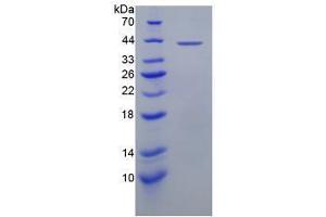 SDS-PAGE analysis of Human Oxytocin Receptor Protein. (Oxytocin Receptor Protein (OXTR))