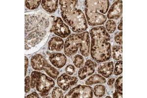 Immunohistochemical staining of human kidney with CPAMD8 polyclonal antibody  shows strong cytoplasmic positivity in cells of tubules at 1:10-1:20 dilution. (CPAMD8 antibody)