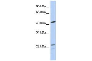 WB Suggested Anti-BCKDHA Antibody Titration: 0.
