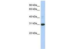 Image no. 1 for anti-Inositol(myo)-1(or 4)-Monophosphatase 1 (IMPA1) (C-Term) antibody (ABIN6744302) (IMPA1 antibody  (C-Term))