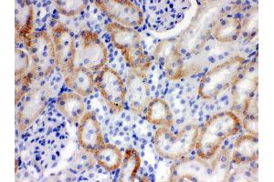 Anti- SLC22A2 Picoband antibody, IHC(P) IHC(P): Rat Kidney Tissue (SLC22A2 antibody  (Middle Region))