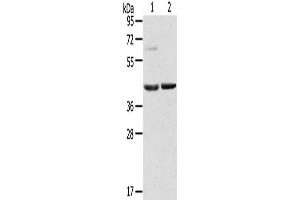 Western Blotting (WB) image for anti-Hypoxia Inducible Factor 1, alpha Subunit Inhibitor (HIF1AN) antibody (ABIN2435282) (HIF1AN antibody)