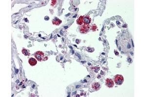 IHC Information: Lung, Human: Formalin-Fixed, Paraffin-Embedded (FFPE) (CYBB antibody  (C-Term))