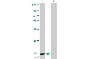 Western Blot analysis of FABP1 expression in transfected 293T cell line by FABP1 monoclonal antibody (M02), clone 5F7. (FABP1 antibody  (AA 1-127))