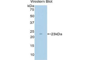 Detection of Recombinant SCFR, Mouse using Polyclonal Antibody to Stem Cell Factor Receptor (SCFR) (KIT antibody  (AA 343-527))