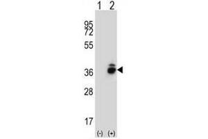 Western blot analysis of CRHBP (arrow) using rabbit polyclonal CRHBP Antibody (N-term) .