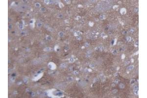 DAB staining on IHC-P; Samples: Mouse Cerebrum Tissue (SYN2 antibody  (AA 88-422))