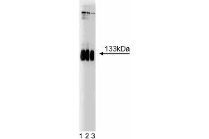 Western blot analysis of mGluR1 on a rat cerebrum lysate. (Metabotropic Glutamate Receptor 1 antibody  (AA 1042-1160))
