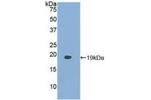 Detection of Recombinant FABP9, Human using Polyclonal Antibody to Fatty Acid Binding Protein 9, Testis (FABP9) (FABP9 antibody  (AA 1-132))