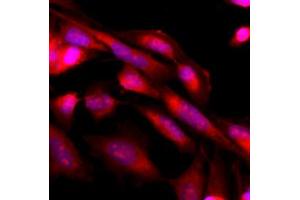 Image no. 2 for anti-Mitogen-Activated Protein Kinase 3 (MAPK3) antibody (ABIN2451499) (ERK1 antibody)
