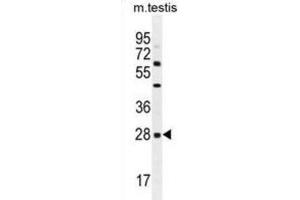 Western Blotting (WB) image for anti-C-Type Lectin Domain Family 12, Member B (CLEC12B) antibody (ABIN2996273)