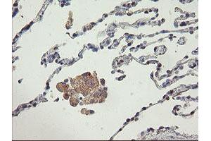 Immunohistochemistry (IHC) image for anti-ATP/GTP Binding Protein 1 (AGTPBP1) (AA 368-753) antibody (ABIN1491460) (AGTPBP1 antibody  (AA 368-753))