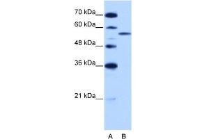 WB Suggested Anti-ZRSR2 Antibody Titration:  2. (ZRSR2 antibody  (C-Term))