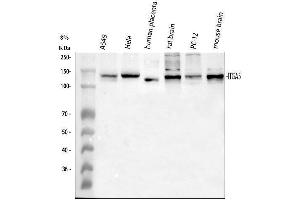 Western blot analysis of ITGA5 using anti-ITGA5 antibody (ABIN5693202). (ITGA5 antibody  (AA 42-263))