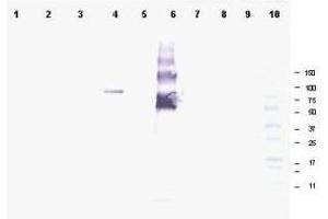 Image no. 1 for anti-Ankyrin Repeat Domain 26 (ANKRD26) (AA 1-15) antibody (ABIN199963) (ANKRD26 antibody  (AA 1-15))