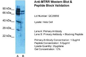 Host: Rabbit  Target Name: MTRR  Sample Tissue: HelaLane A:  Primary Antibody Lane B:  Primary Antibody + Blocking Peptide Primary Antibody Concentration: 1 µg/mL Peptide Concentration: 5. (MTRR antibody  (N-Term))