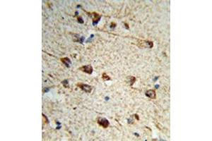 Formalin-fixed and paraffin-embedded human brain tissue reacted with Fibromodulin Antibody (C-term) followed which was peroxidase-conjugated to the secondary antibody, followed by DAB staining.
