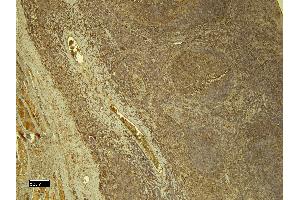 (ABIN5539581) (8 μg/mL) staining of paraffin embedded Human Tonsil. (STAT5A antibody  (C-Term))