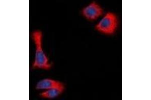 Immunofluorescent analysis of STMN1 staining in Hela cells. (Stathmin 1 antibody  (N-Term))