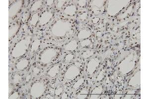 Immunoperoxidase of monoclonal antibody to SGK on formalin-fixed paraffin-embedded human kidney. (SGK1 antibody  (AA 1-431))
