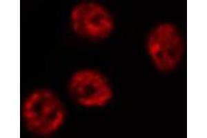 ABIN6269179 staining HT29 by IF/ICC. (AFT1 antibody  (Internal Region))