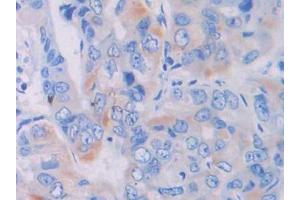 Used in DAB staining on fromalin fixed paraffin- embedded liver tissue (LGALS9B antibody  (AA 17-148))