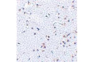 Immunohistochemistry of TSLP in human brain tissue with TSLP polyclonal antibody  at 2. (Thymic Stromal Lymphopoietin antibody  (C-Term))