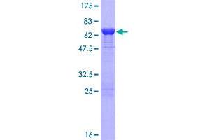 Vinexin Protein (AA 1-329) (GST tag)