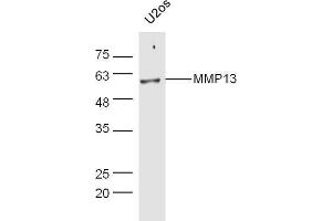 Human U2os lysates probed with Rabbit Anti-MMP13 Polyclonal Antibody, Unconjugated  at 1:5000 for 90 min at 37˚C. (MMP13 antibody  (AA 201-300))