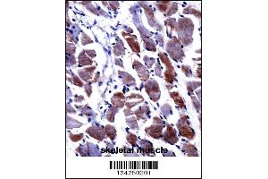DPYSL3 Antibody immunohistochemistry analysis in formalin fixed and paraffin embedded human skeletal muscle followed by peroxidase conjugation of the secondary antibody and DAB staining. (DPYSL3 antibody  (C-Term))