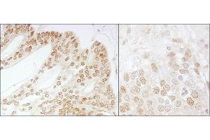 Immunohistochemistry (IHC) image for anti-COP9 Constitutive Photomorphogenic Homolog Subunit 5 (Arabidopsis) (COPS5) (AA 175-225) antibody (ABIN7449381) (COPS5 antibody  (AA 175-225))