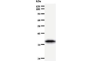 Western Blotting (WB) image for anti-Twist Homolog 1 (Drosophila) (TWIST1) antibody (ABIN933111) (TWIST1 antibody)