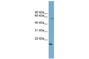 WB Suggested Anti-ZNF83 Antibody Titration:  0. (ZNF83 antibody  (N-Term))