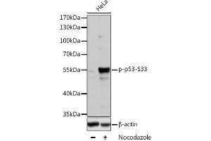 Western blot analysis of extracts of HT-29 cells using Phospho-p53(S33) Polyclonal Antibody at dilution of 1:2000. (p53 antibody  (pSer33))