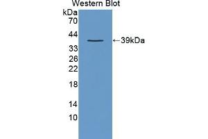 Detection of Recombinant CRKL, Human using Polyclonal Antibody to Crk Like Protein (CRKL) (CrkL antibody  (AA 1-303))