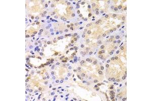Immunohistochemistry of paraffin-embedded human kidney using PSMC6 antibody.