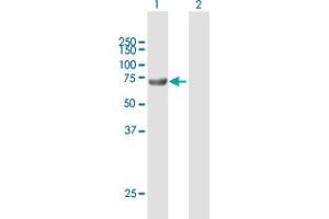 Western Blot analysis of ACSBG2 expression in transfected 293T cell line by ACSBG2 MaxPab polyclonal antibody. (ACSBG2 antibody  (AA 1-666))