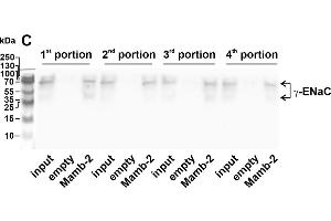 Whole membranes used for the analysis of the molecular targets extracted by mambalgin-2 from membrane fraction of A549 cells. (SCNN1G antibody  (AA 80-401))