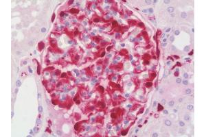 Anti-AIF1 / IBA1 antibody IHC staining of human kidney.