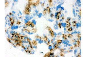 Anti- Band 3 Picoband antibody,IHC(F) IHC(F): Human Placenta Tissue (Band 3/AE1 antibody  (AA 28-365))