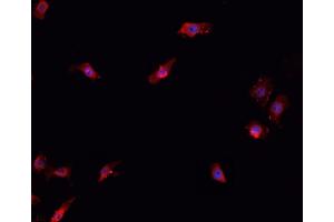 ABIN6266706 staining K-562 cells by IF/ICC. (T-Box 1 antibody  (C-Term))