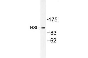 Image no. 1 for anti-Lipase, Hormone-Sensitive (LIPE) antibody (ABIN317711) (LIPE antibody)