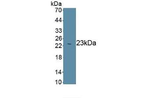 Detection of Recombinant Smad3, Human using Monoclonal Antibody to SMAD family member 3 (SMAD3) (SMAD3 antibody  (AA 231-425))