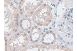 Detection of GPX3 in Human Kidney Tissue using Polyclonal Antibody to Glutathione Peroxidase 3, Plasma (GPX3) (GPX3 antibody  (AA 21-72))